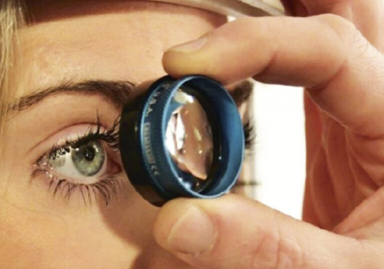 CAMBIOS EN EL MANEJO MÉDICO DEL GLAUCOMA