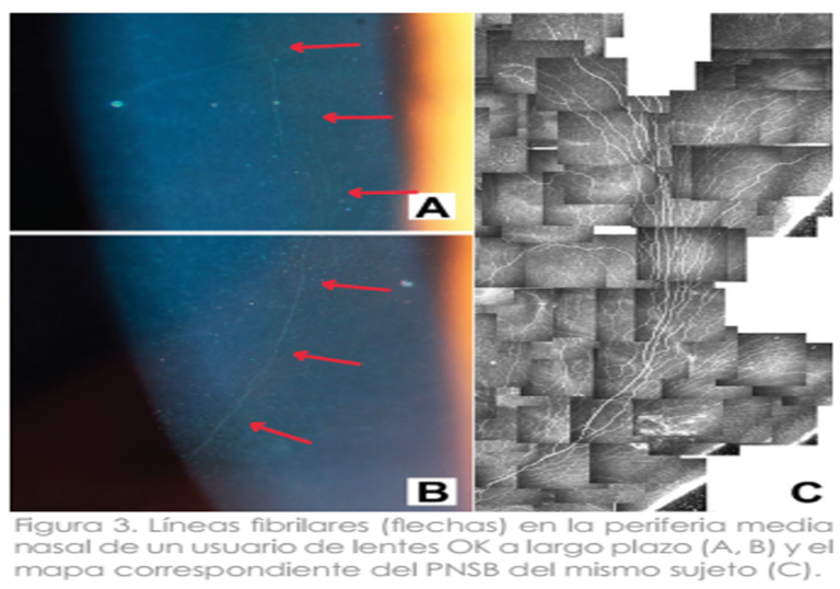 INERVACIÓN CORNEAL EN CONDICIONES DE ESTRÉS MECÁNICO