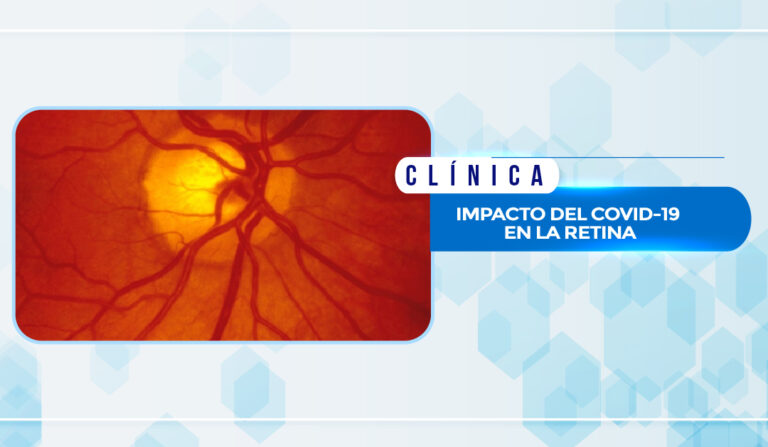 IMPACTO DEL COVID-19 EN LA RETINA