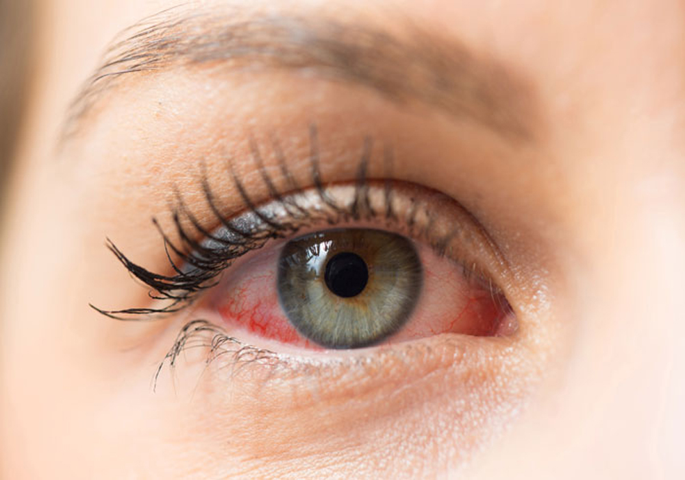Una de cada 10 mujeres en Reino Unido tiene ojo seco - Franja Ocular
