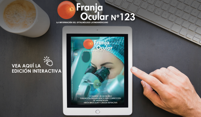Franja ocular 123