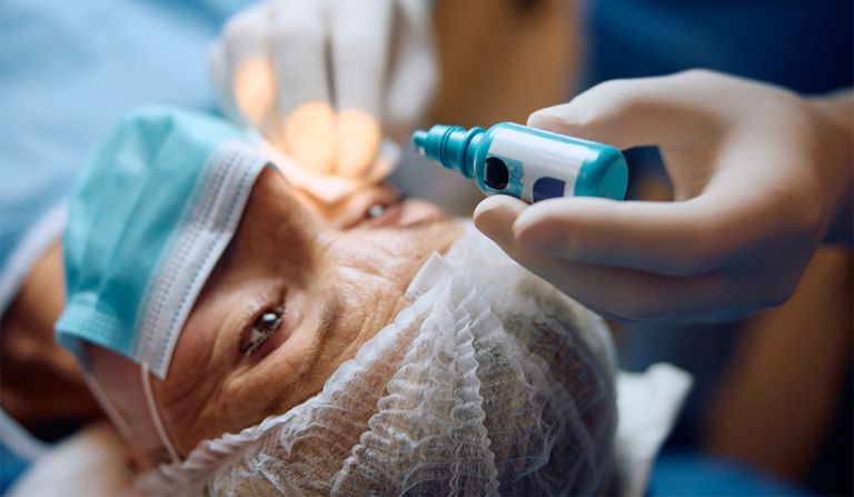 Cambios en el endotelio corneal por cirugía de catarata