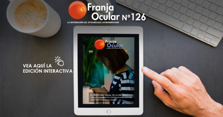  Franja Ocular 126 