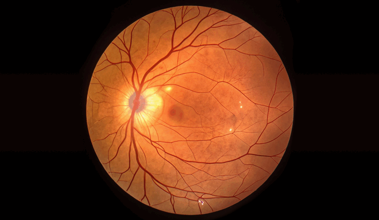 La otra mitad de la retina: glía, inmunidad y neuroprotección en equilibrio