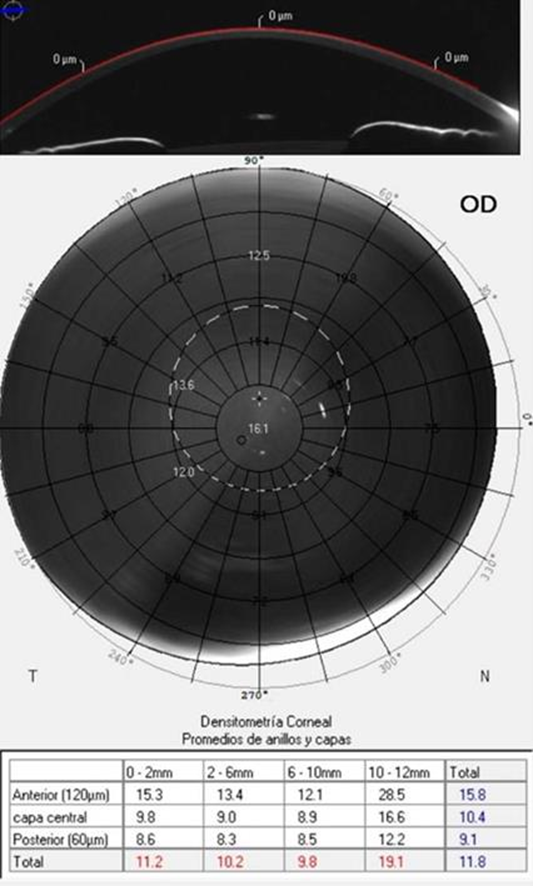 image - Franja Ocular