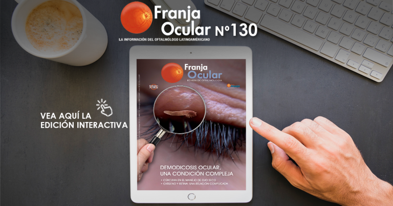 Franja ocular 130