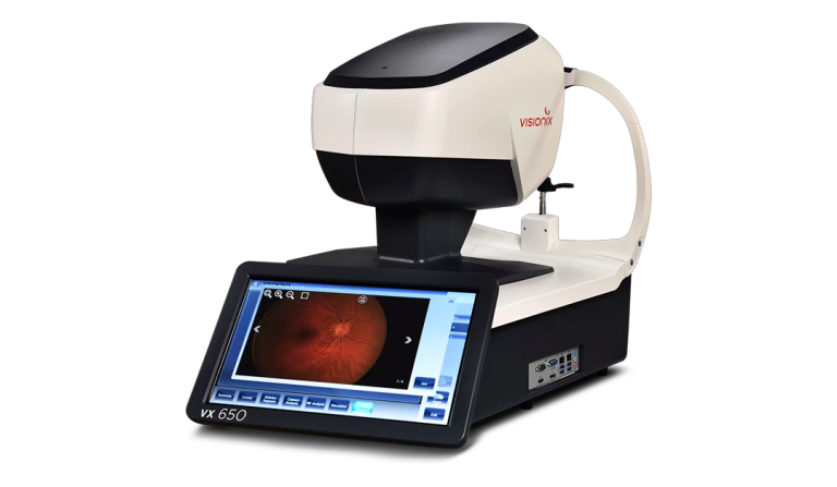 VX 650 incorpora ia para el análisis retiniano