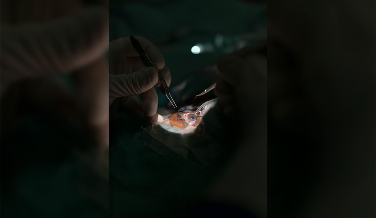 Controlar la luz, recuperar la visión: el primer iris artificial en Colombia