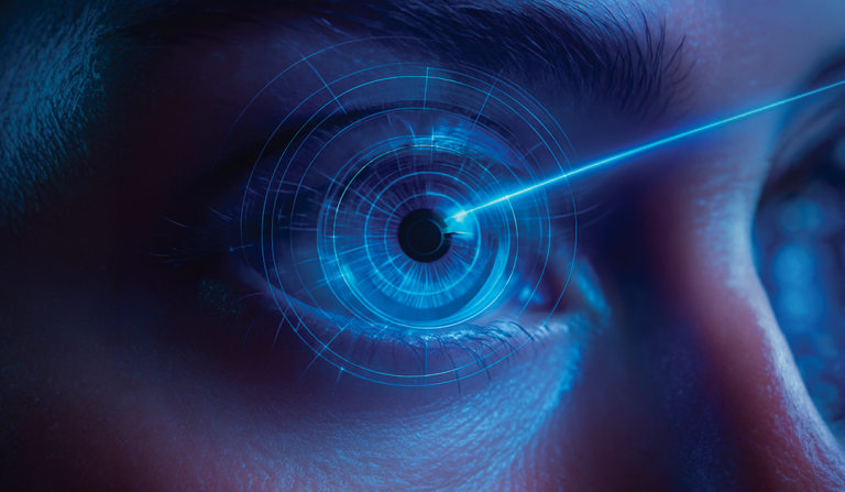 LASIK AVANZA: NUEVA TECNOLOGÍA SUPERA A SMILE PRO