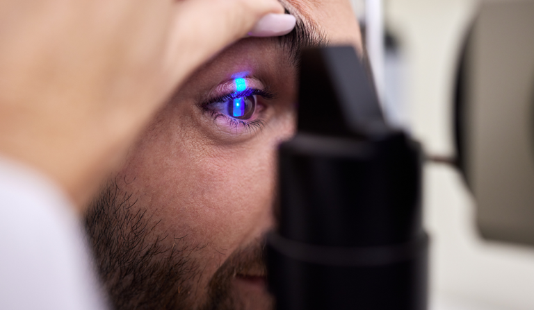 Queratografía fluoresceínica. Una propuesta emergente en la evaluación del epitelio corneal