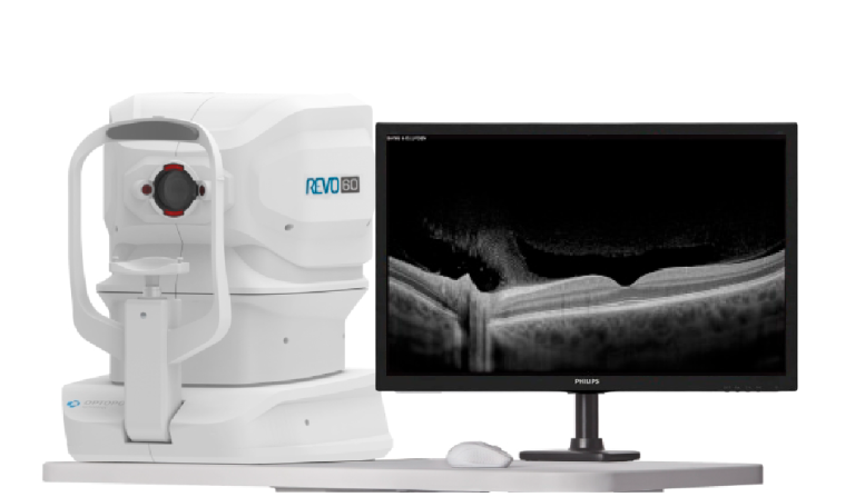 Imagenología multimodal con IA: la propuesta REVO de OPTOPOL Technology