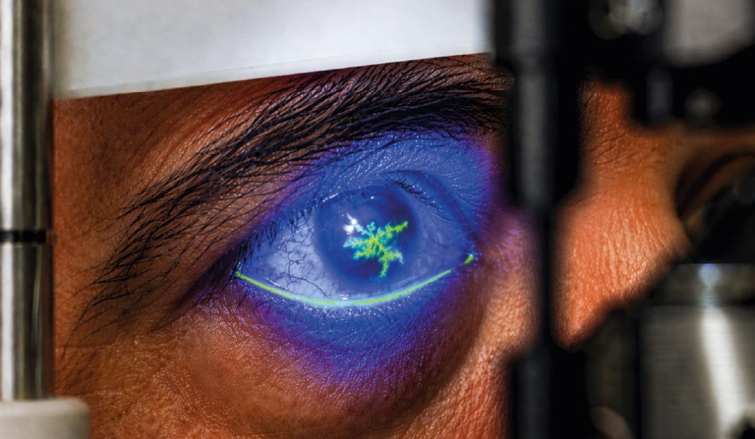 Close-up of a human eye in blue light during an eye exam, with a glowing green pattern visible in the cornea.