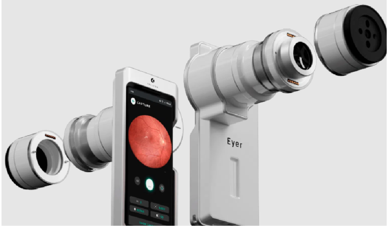 Smartphone attached to a retinal imaging device displaying a red retina on the screen, with paired silver lens modules nearby.