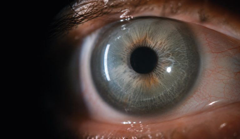 Close-up of a blue-gray iris with a dark pupil and visible blood vessels around the white of the eye.