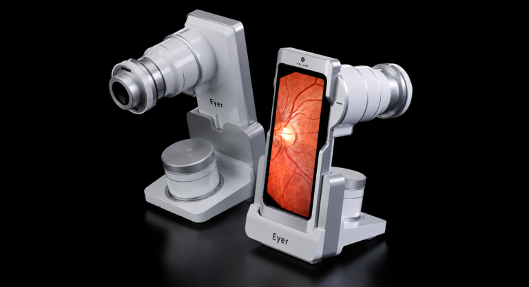 High-tech eye examination device with a smartphone display showing a retinal image, labeled 'Eyer' on the stand and arms.