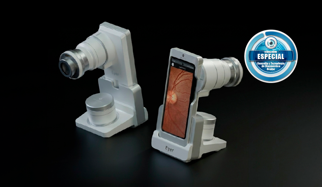 Two white ophthalmic diagnostic devices on a dark surface, one displaying a retinal image on a smartphone screen.