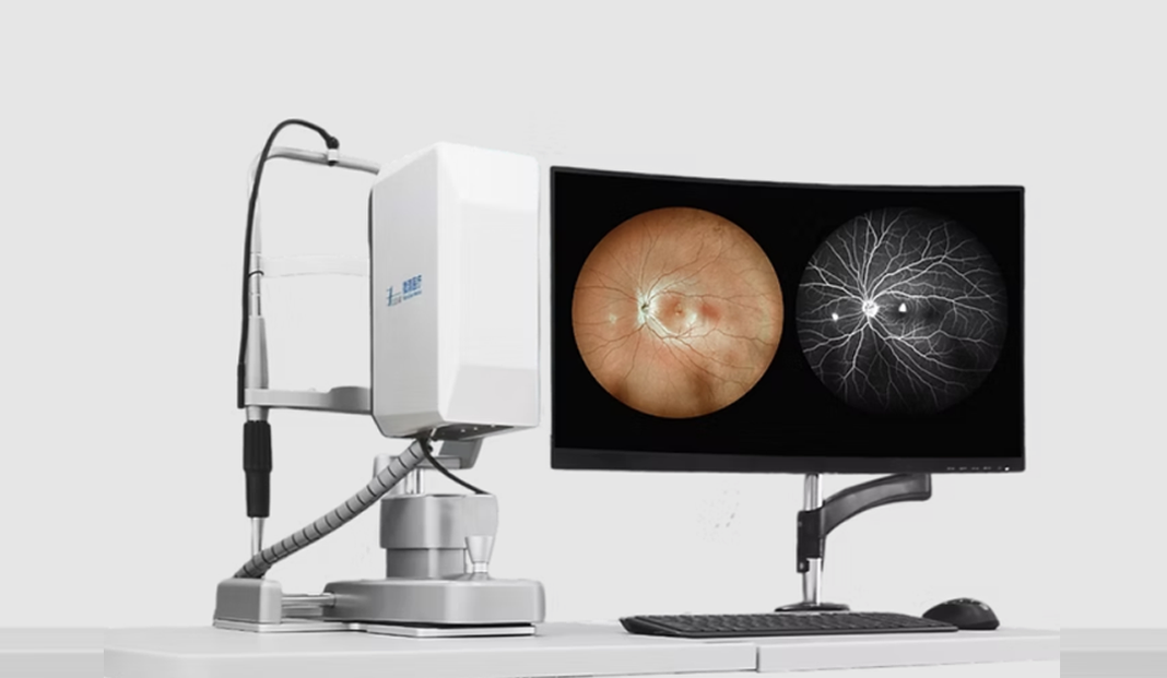 Ophthalmic fundus camera connected to a monitor showing two retinal images side by side, for eye examination.