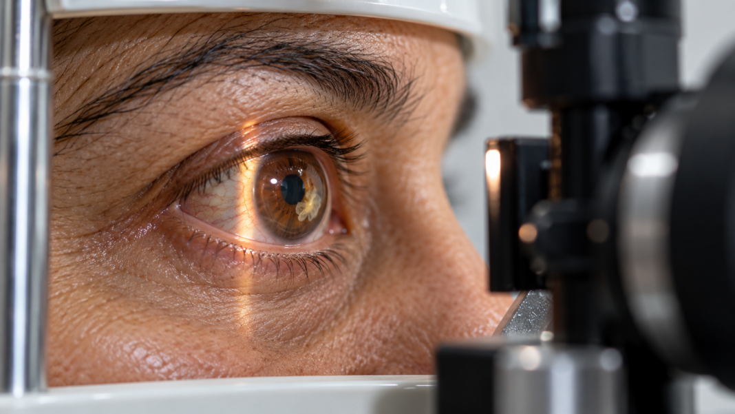 Close-up of a brown eye during an ophthalmic slit-lamp exam.